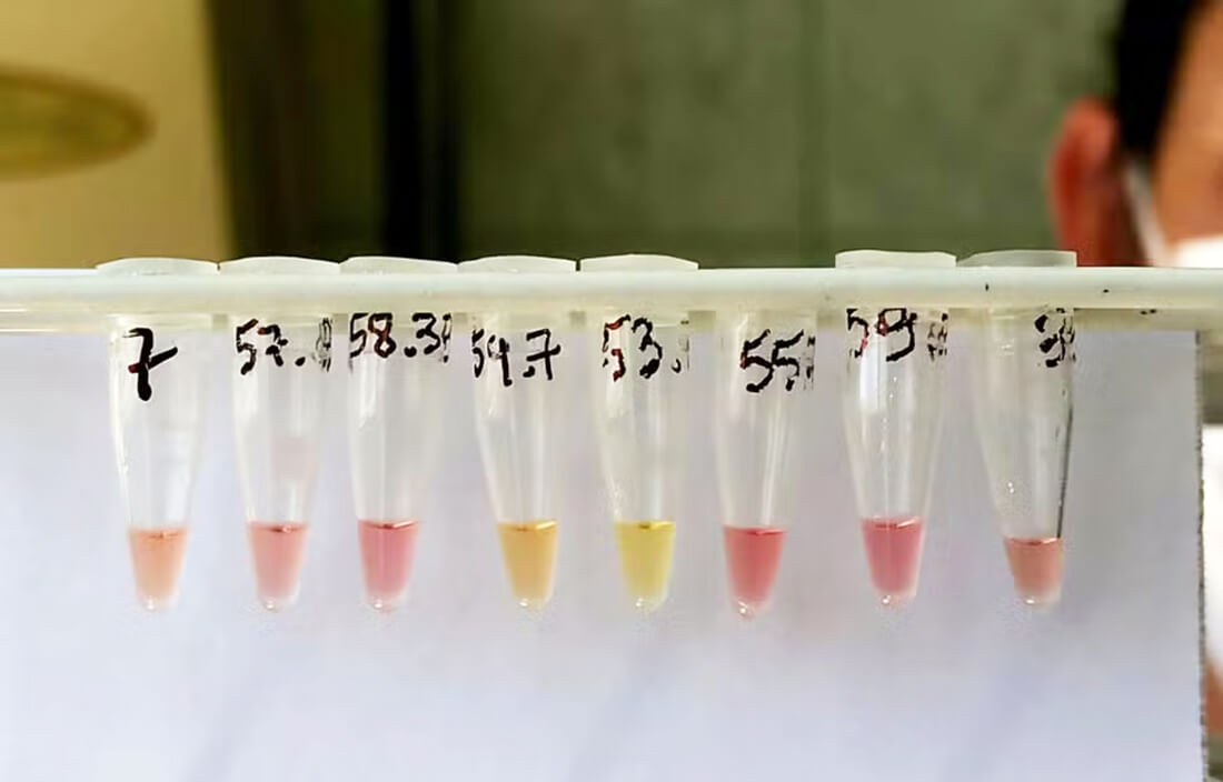 Capa Pesquisadora da UFSM desenvolve teste rápido para tuberculose