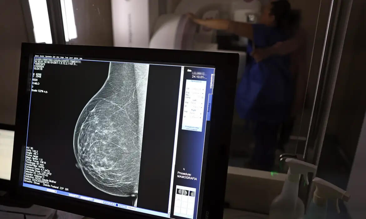 Capa Estudo com RNA tem método que pode ajudar a tratar câncer de mama
