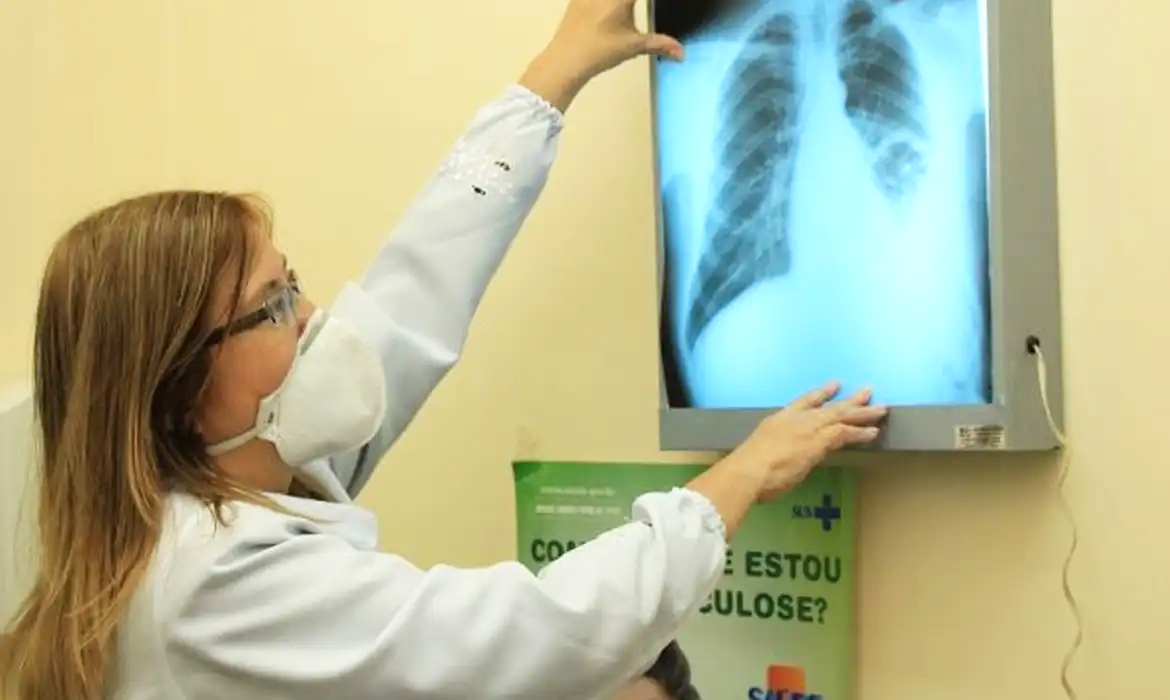 Capa Um terço da população mundial corre risco de desenvolver tuberculose