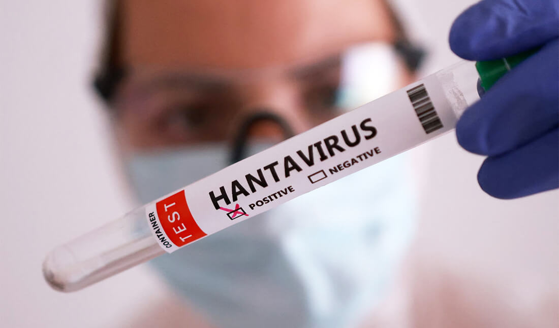 Capa Confirmado primeiro óbito por hantavírus no país em 2026