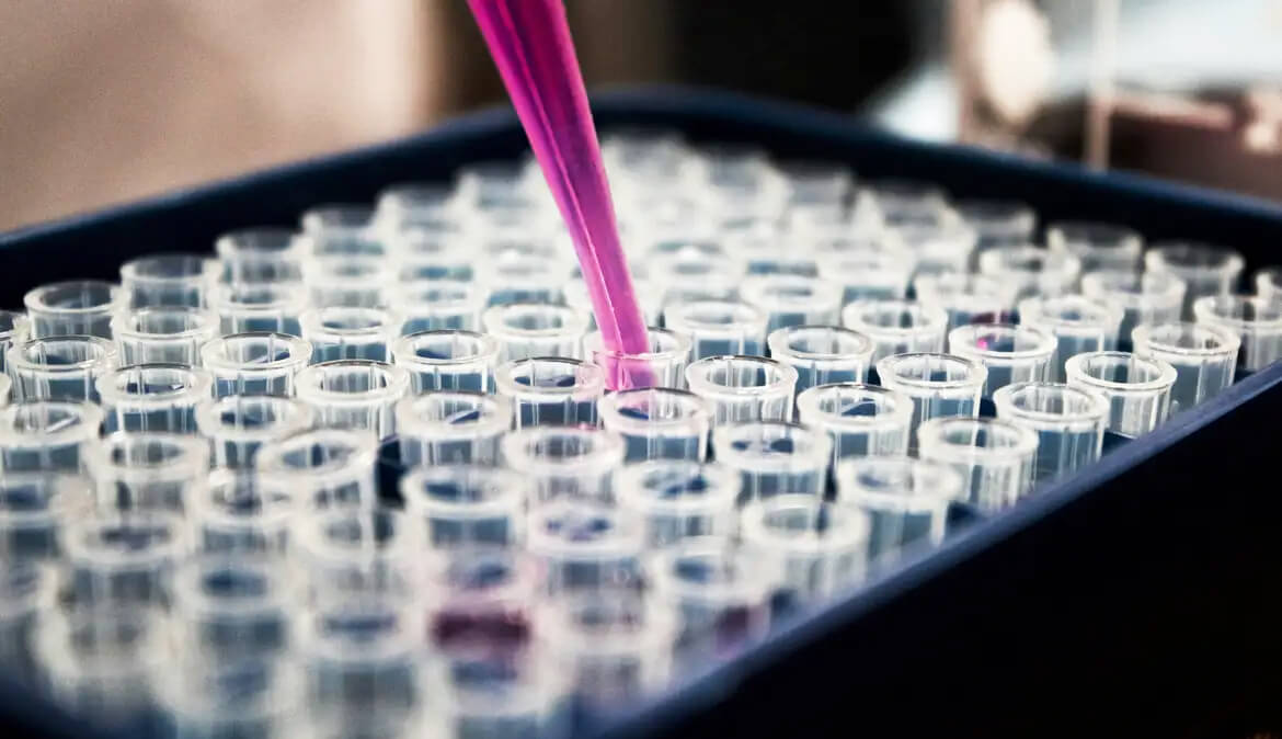 Capa UFRJ descobre molécula promissora no combate ao Alzheimer