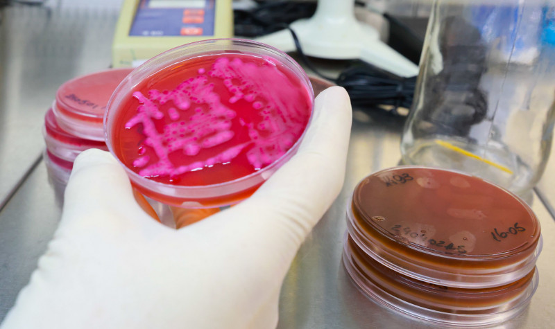 Capa Estado tem mais de 800 casos suspeitos de leptospirose em análise