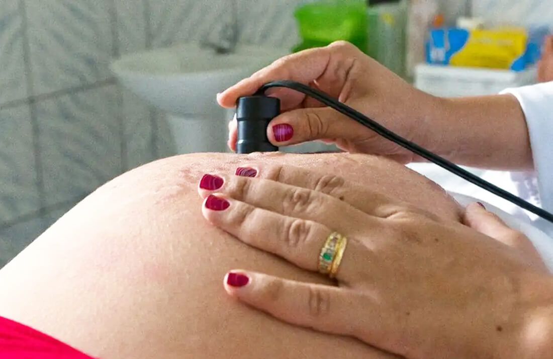 Capa Estudo alerta para risco da cafeína no desenvolvimento do bebê