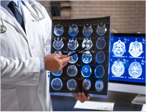 Capa População alpestrense passa a ter atendimentos de neurologista