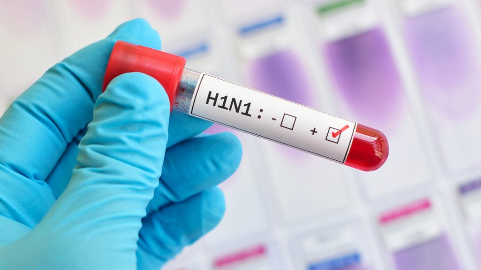 Capa Hospital de Planalto restringe visitas diante do aumento de casos de Influenza e H1N1