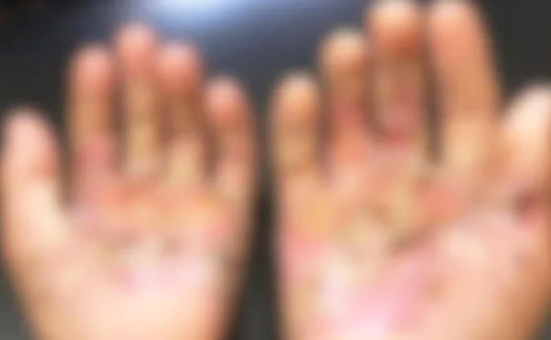 Capa Mulher é presa suspeita de queimar mãos do filho e jogar sal nas feridas no RS