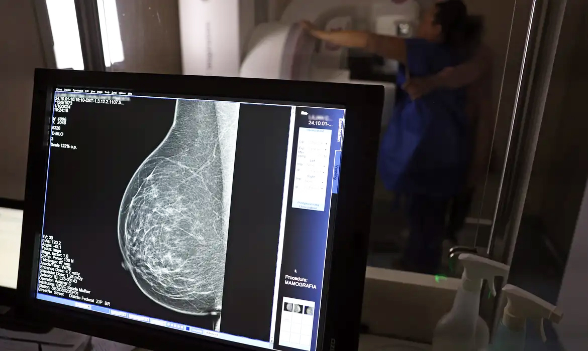 Capa Câncer de mama: 10% dos casos têm origem hereditária