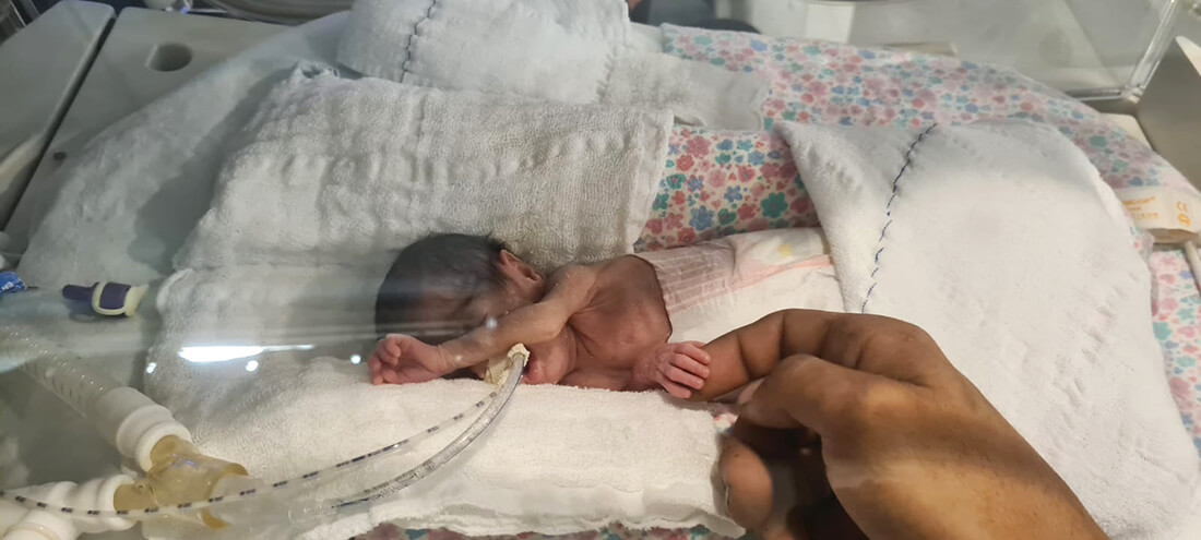 Capa Bebê que nasceu com o menor peso na história do Hospital de Clínicas de Porto Alegre recebe alta