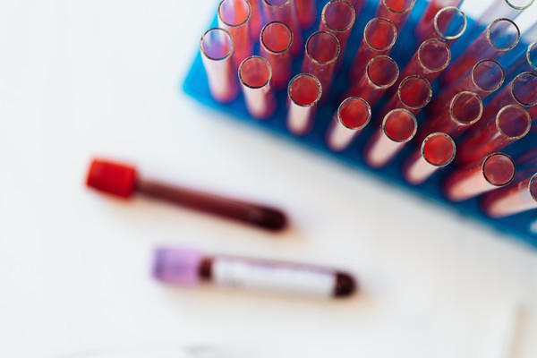 Capa Estado emite alerta epidemiológico sobre a monkeypox