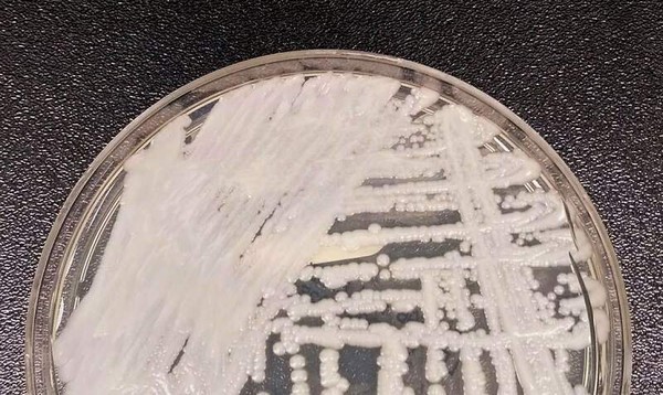 Capa Anvisa alerta sobre superfungo