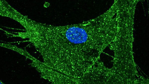 Capa Cientistas rejuvenescem em 30 anos células de pele humana