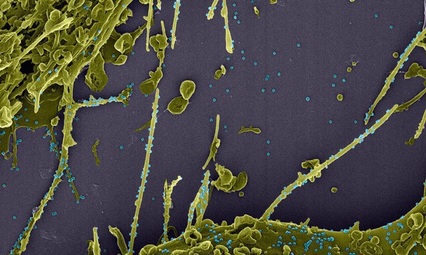 Capa Subvariante da Ômicron é mais infecciosa que "original", diz estudo