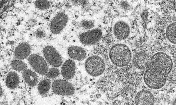 Capa Brasil inicia negociações para obter vacinas contra monkeypox