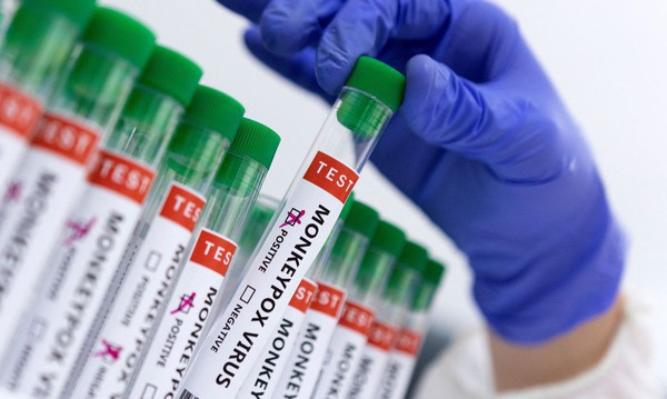 Capa Anvisa orienta hospitais sobre casos de varíola dos macacos