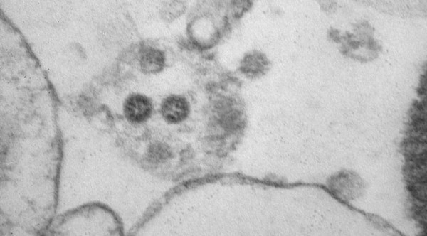 Capa Estudo aponta menor gravidade da variante Ômicron nos pulmões